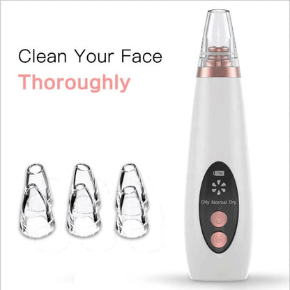 Rechargeable Microcrystalline Blackhead Remover Device