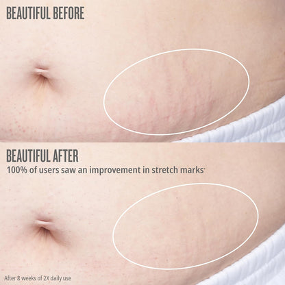 Sol de Janeiro Bum Bum Firmeza Body Oil - Stretch Mark Oil