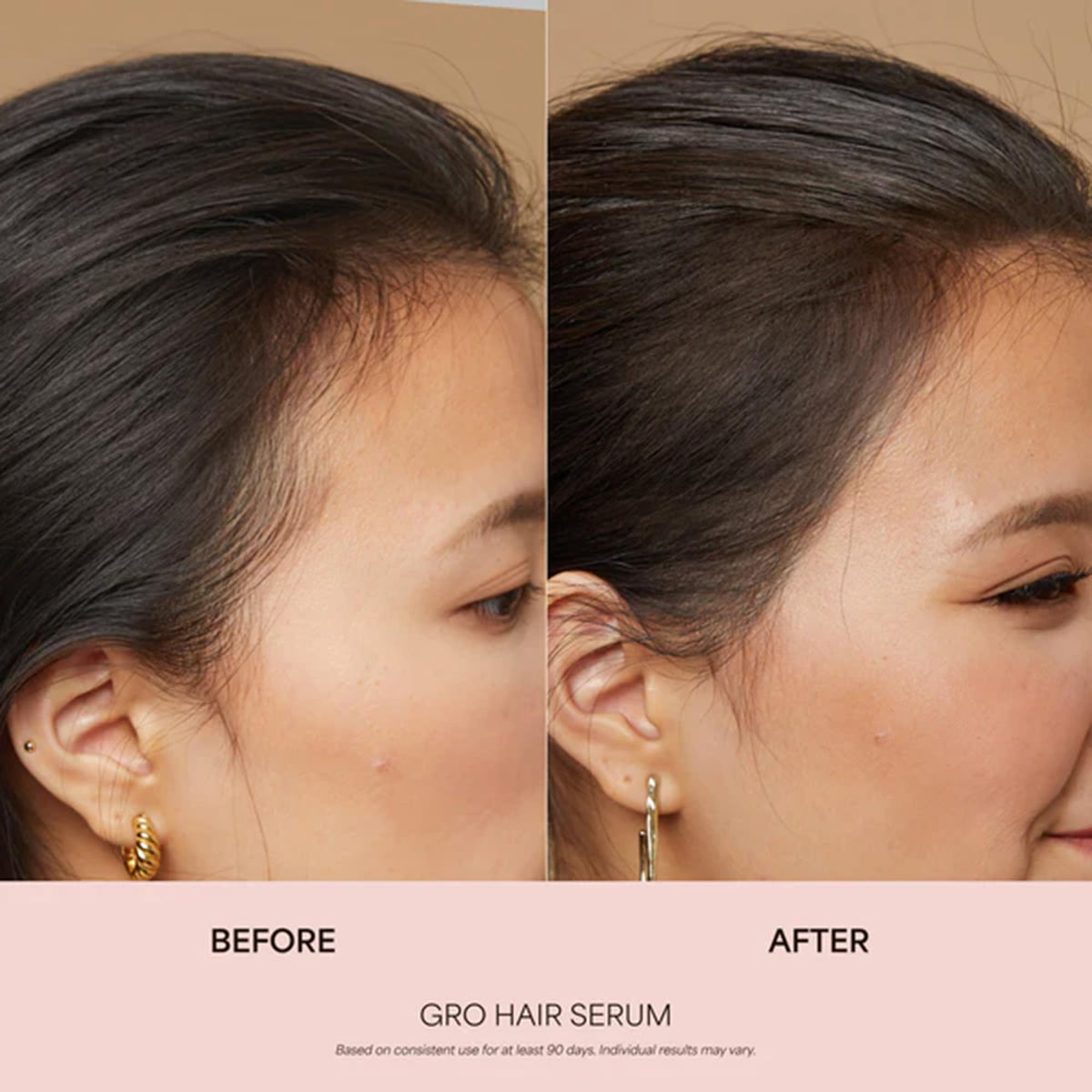 VEGAMOUR GRO Hair Serum for Hair Thinning &amp; Shedding, Thicker Fuller Looking Hair In As Soon As 90 Days, Non Oily, Bergamot Scent, Vegan &amp; Cruelty Free