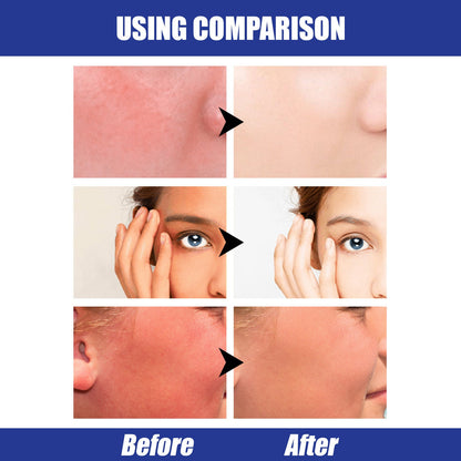 Lightweight SPF50 Hyaluronic Sunscreen Stick
