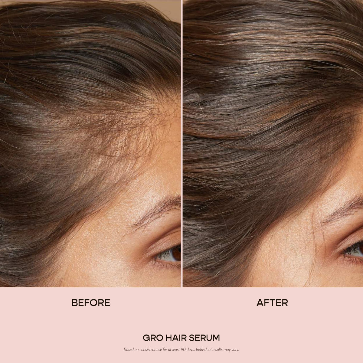 VEGAMOUR GRO Hair Serum for Hair Thinning &amp; Shedding, Thicker Fuller Looking Hair In As Soon As 90 Days, Non Oily, Bergamot Scent, Vegan &amp; Cruelty Free