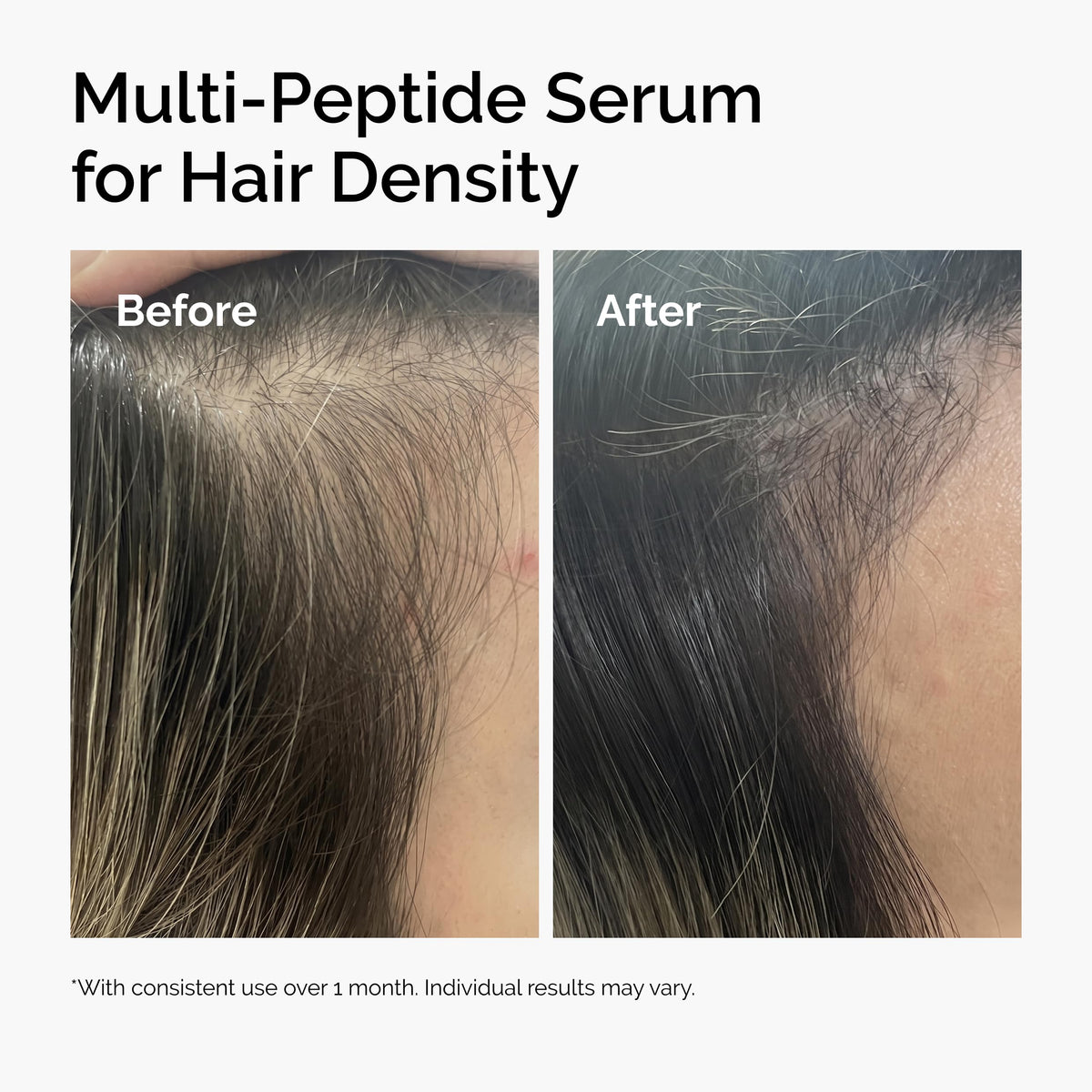 The Ordinary Multi-Peptide Serum for Hair Density, Peptide-Powered Formula for Thicker, Fuller Looking Hair