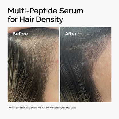 The Ordinary Multi-Peptide Serum for Hair Density, Peptide-Powered Formula for Thicker, Fuller Looking Hair