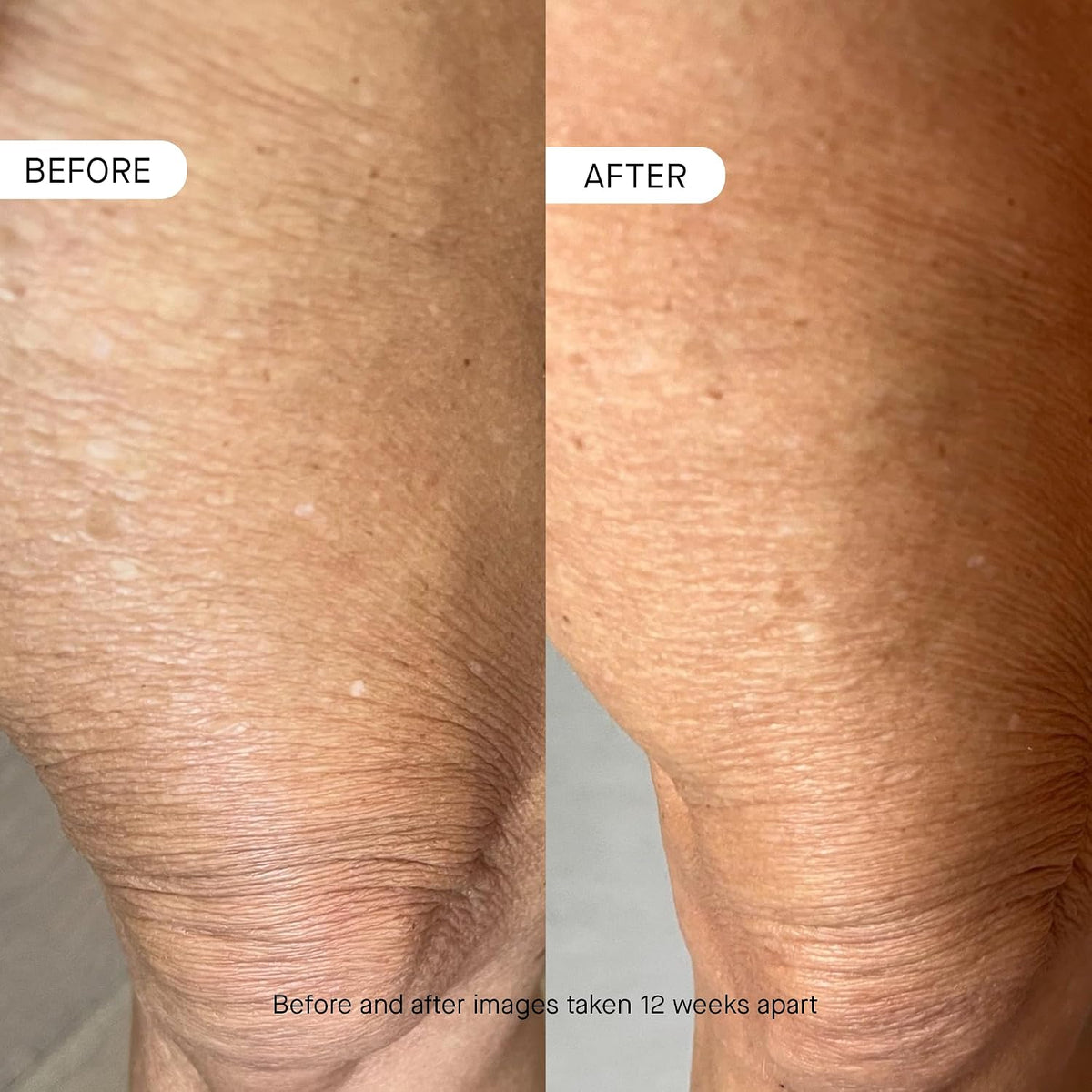 OneSkin BODY OS-01 Peptide Topical Supplement &amp; Skin Longevity Age Reversal Moisturizer | Safe for Sensitive Skin, Fragrance-Free, 250 mL / 8.45 oz