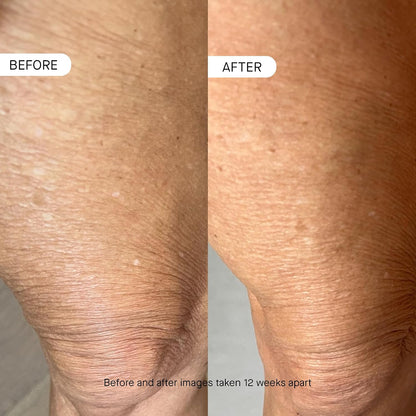 OneSkin BODY OS-01 Peptide Topical Supplement &amp; Skin Longevity Age Reversal Moisturizer | Safe for Sensitive Skin, Fragrance-Free, 250 mL / 8.45 oz