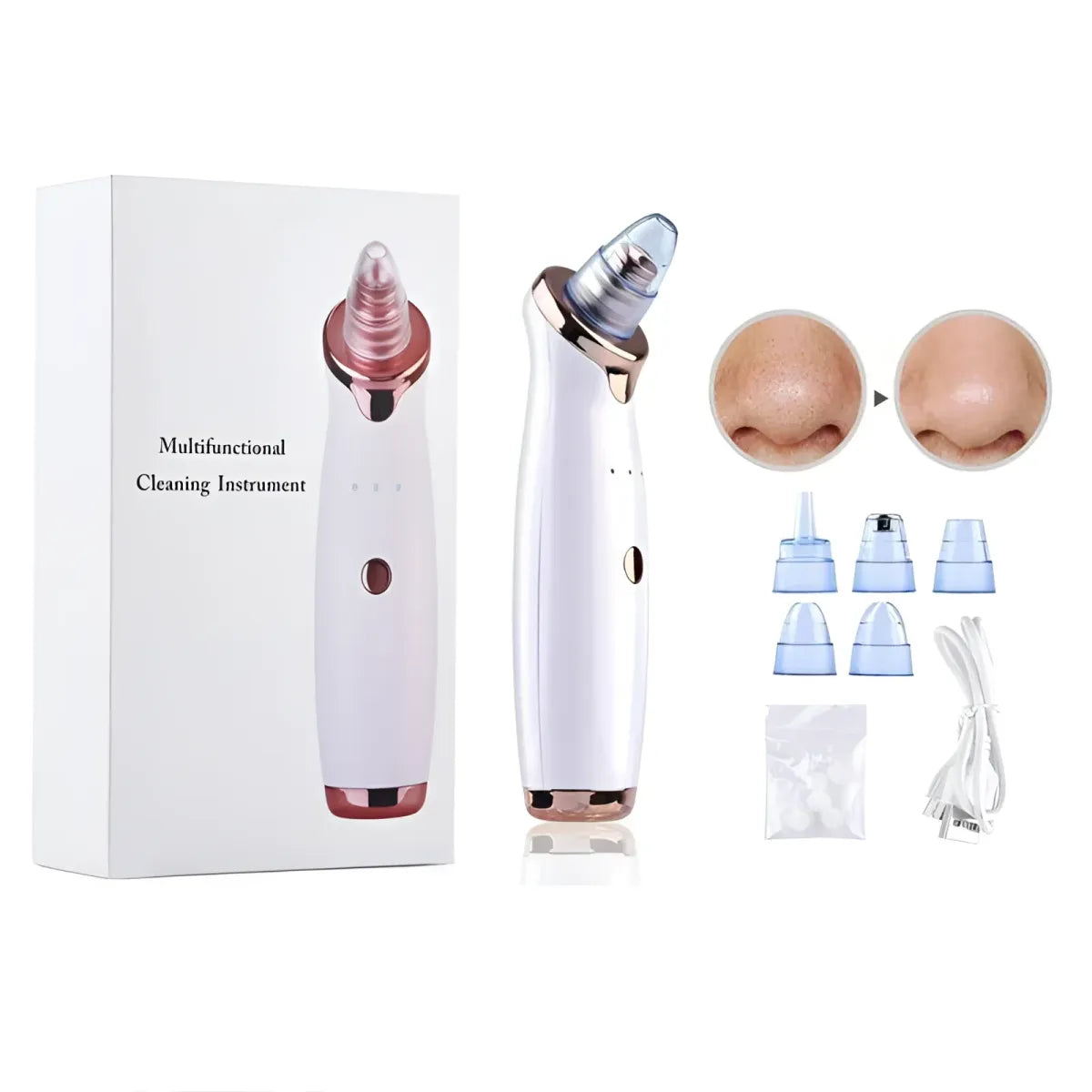 Blackhead Remover